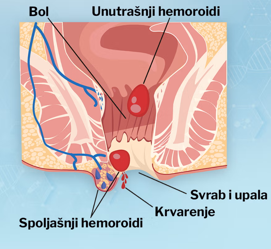 Hemoroidi – anatomija i proširene vene